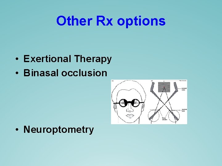 Other Rx options • Exertional Therapy • Binasal occlusion • Neuroptometry Other Rx options • Exertional Therapy • Binasal occlusion • Neuroptometry