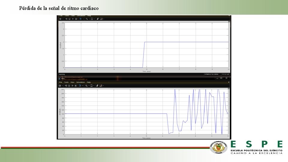 Pérdida de la señal de ritmo cardiaco 