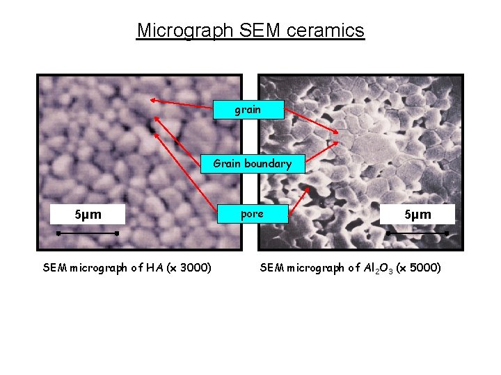 Micrograph SEM ceramics grain Grain boundary 5μm SEM micrograph of HA (x 3000) pore