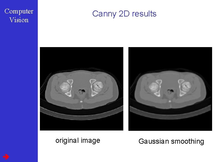 Computer Vision Canny 2 D results original image Gaussian smoothing 