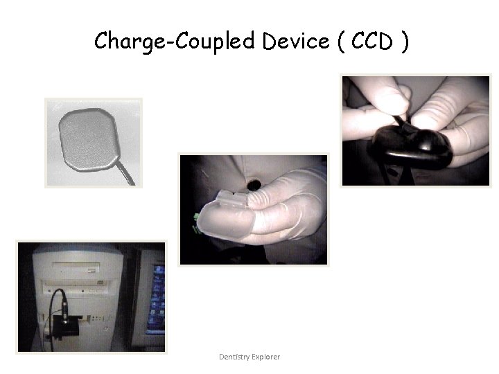 Charge-Coupled Device ( CCD ) Dentistry Explorer 