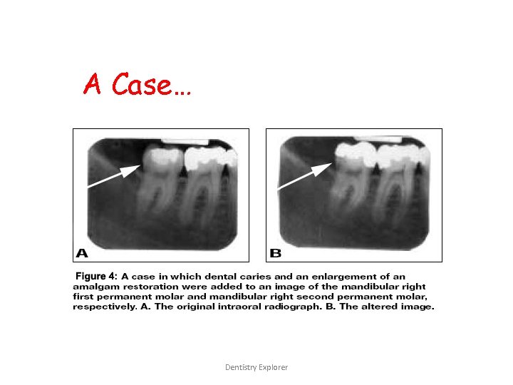 A Case… Dentistry Explorer 