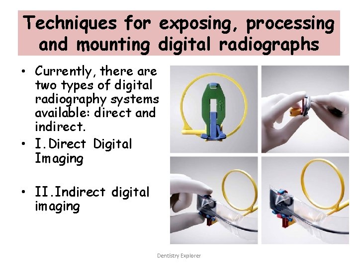 Techniques for exposing, processing and mounting digital radiographs • Currently, there are two types