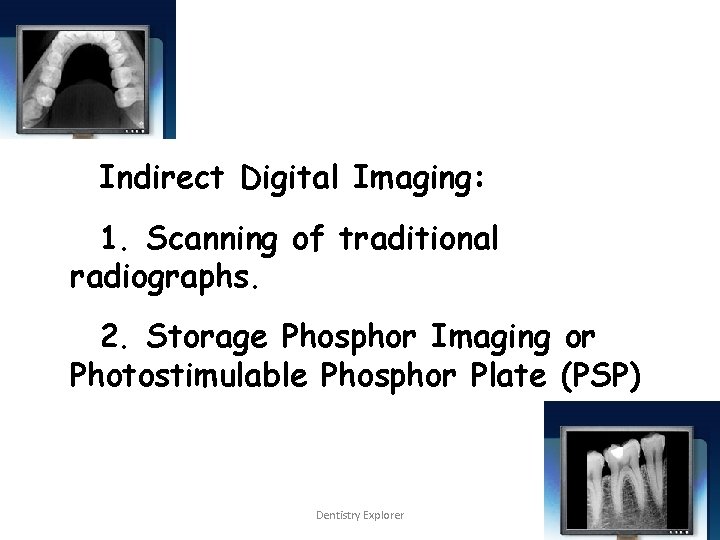 Indirect Digital Imaging: 1. Scanning of traditional radiographs. 2. Storage Phosphor Imaging or Photostimulable