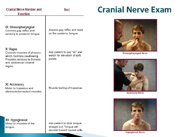 Cranial Nerve Exam 