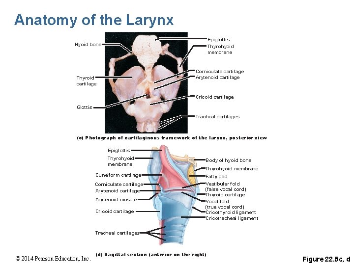 Anatomy of the Larynx Epiglottis Thyrohyoid membrane Hyoid bone Corniculate cartilage Arytenoid cartilage Thyroid