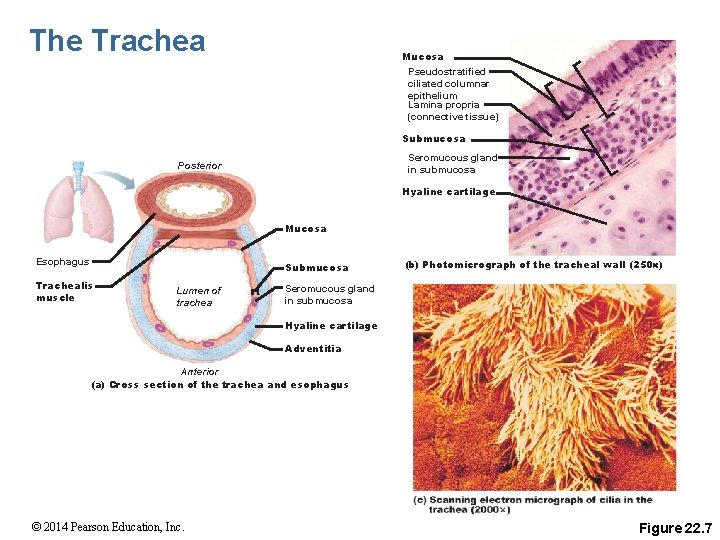 The Trachea Mucosa Pseudostratified ciliated columnar epithelium Lamina propria (connective tissue) Submucosa Seromucous gland