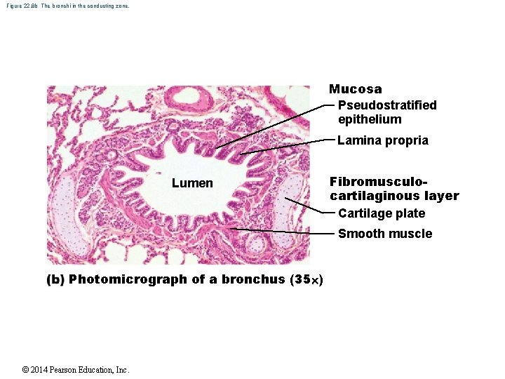 Figure 22. 8 b The bronchi in the conducting zone. Mucosa Pseudostratified epithelium Lamina