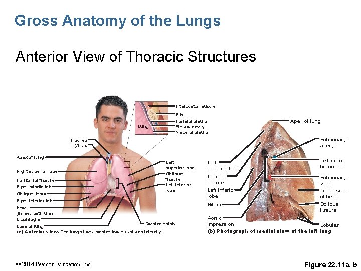 Gross Anatomy of the Lungs Anterior View of Thoracic Structures Intercostal muscle Rib Parietal