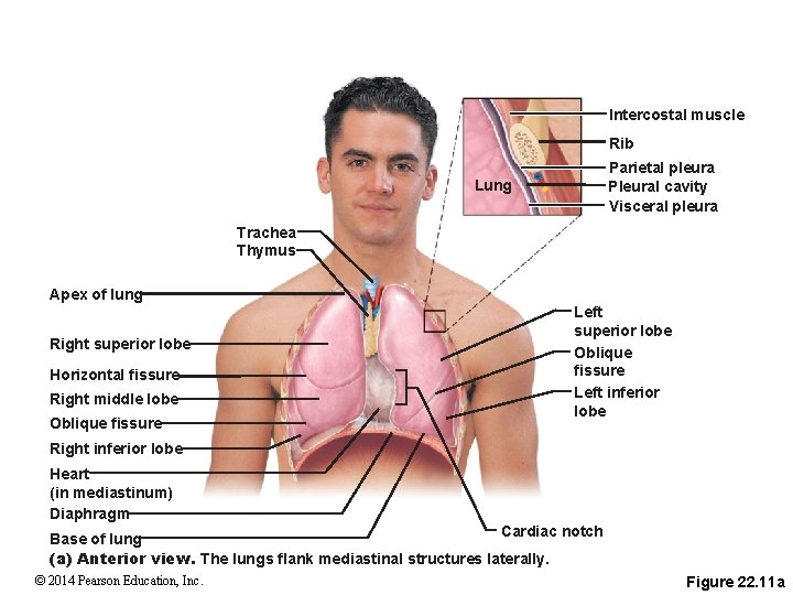 Intercostal muscle Rib Parietal pleura Pleural cavity Visceral pleura Lung Trachea Thymus Apex of