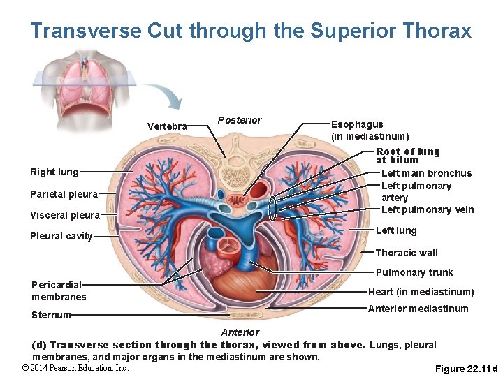 Transverse Cut through the Superior Thorax Vertebra Right lung Parietal pleura Visceral pleura Pleural