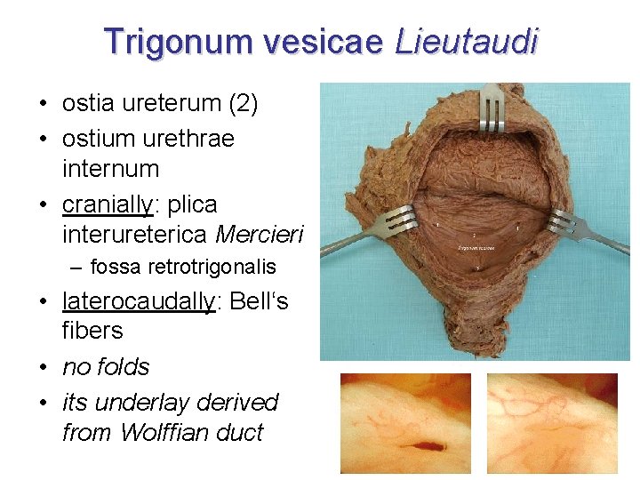 Trigonum vesicae Lieutaudi • ostia ureterum (2) • ostium urethrae internum • cranially: plica