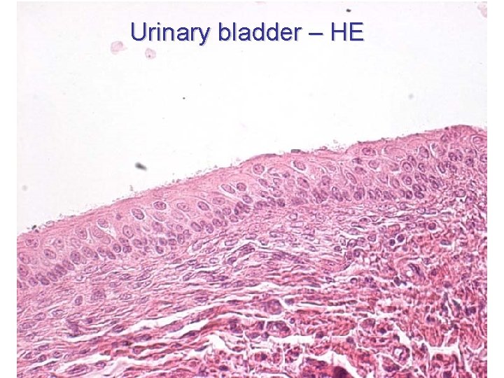 Urinary bladder – HE 