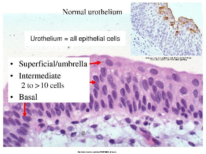 http: //images. novusbio. com/fullsize/Uroplakin-III-Antibody-%28 SP 73%29 Immunohistochemistry-Paraffin-NBP 2 -12482 -img 0004. jpg http: //www.