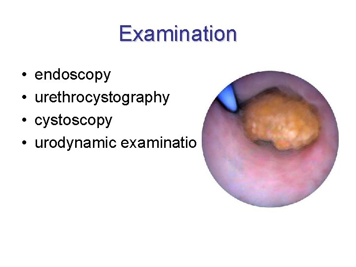 Examination • • endoscopy urethrocystography cystoscopy urodynamic examination 