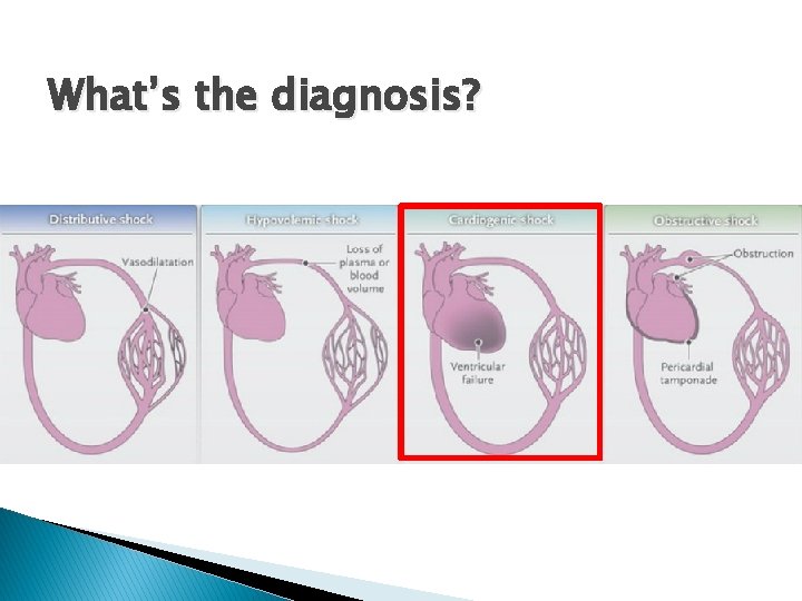 What’s the diagnosis? 