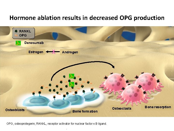 Hormone ablation results in decreased OPG production Denosumab Estrogen X Androgen Osteoblasts Bone formation