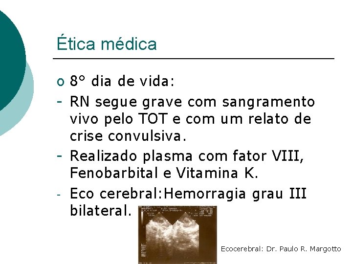 Ética médica o 8° dia de vida: - RN segue grave com sangramento vivo