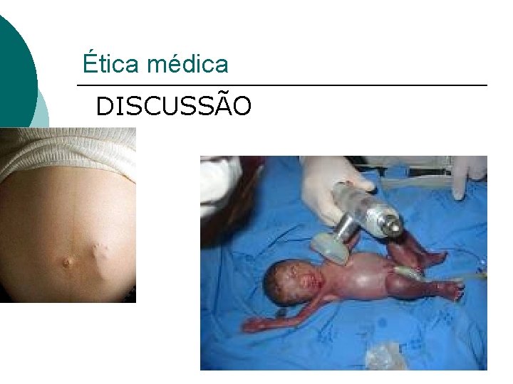 Ética médica DISCUSSÃO 