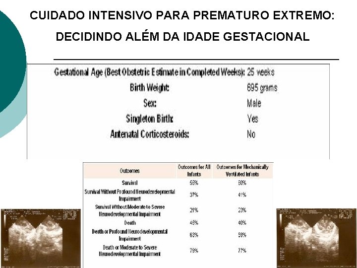 CUIDADO INTENSIVO PARA PREMATURO EXTREMO: DECIDINDO ALÉM DA IDADE GESTACIONAL Outro exemplo: HRAS 