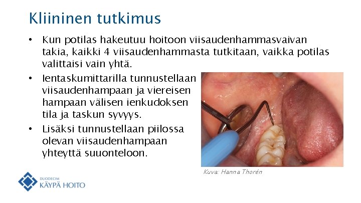 Kliininen tutkimus • Kun potilas hakeutuu hoitoon viisaudenhammasvaivan takia, kaikki 4 viisaudenhammasta tutkitaan, vaikka