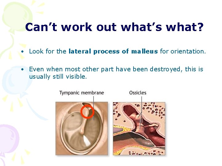 Can’t work out what’s what? • Look for the lateral process of malleus for Can’t work out what’s what? • Look for the lateral process of malleus for