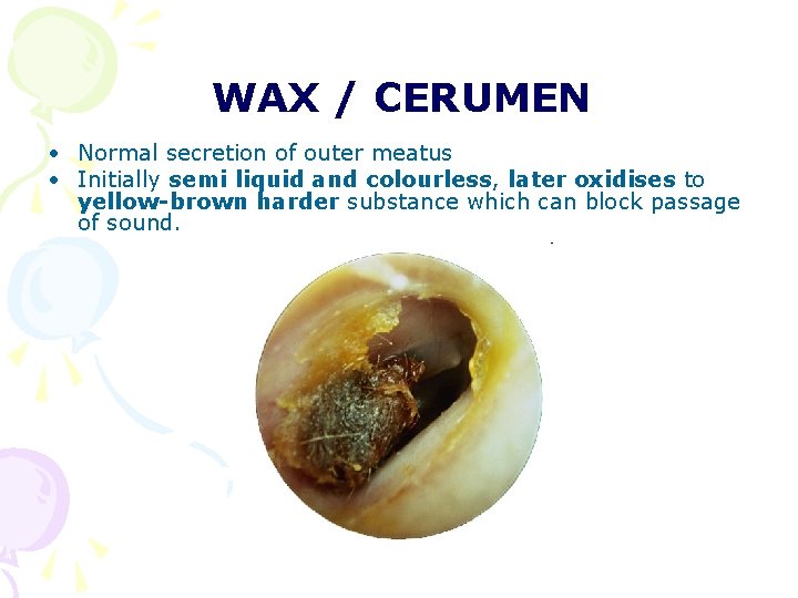 WAX / CERUMEN • Normal secretion of outer meatus • Initially semi liquid and WAX / CERUMEN • Normal secretion of outer meatus • Initially semi liquid and
