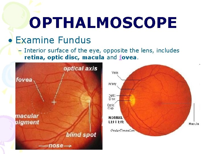 OPTHALMOSCOPE • Examine Fundus – Interior surface of the eye, opposite the lens, includes OPTHALMOSCOPE • Examine Fundus – Interior surface of the eye, opposite the lens, includes