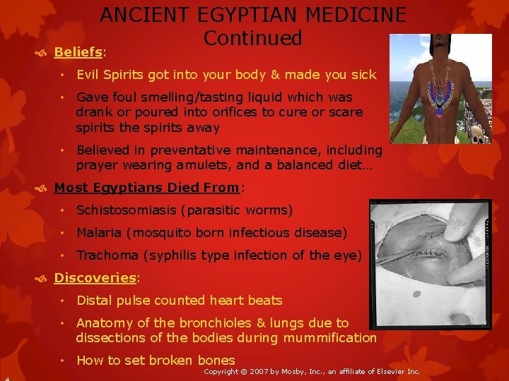ANCIENT EGYPTIAN MEDICINE Continued Beliefs: • Evil Spirits got into your body & made