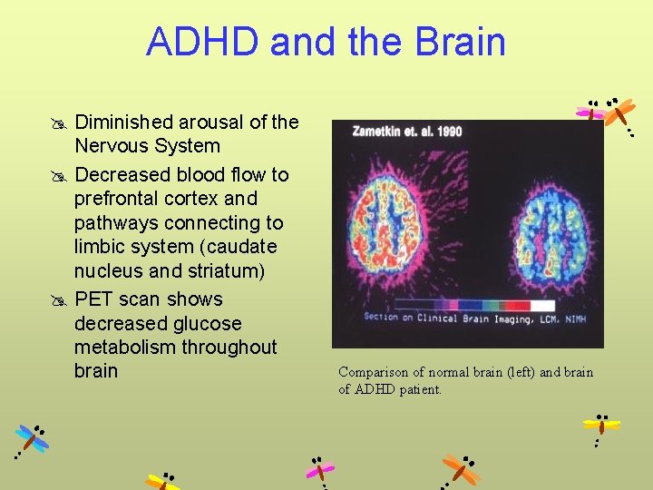 ADHD and the Brain @ Diminished arousal of the Nervous System @ Decreased blood