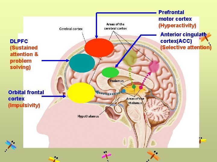 Prefrontal motor cortex (Hyperactivity) DLPFC (Sustained attention & problem solving) Orbital frontal cortex (Impulsivity)