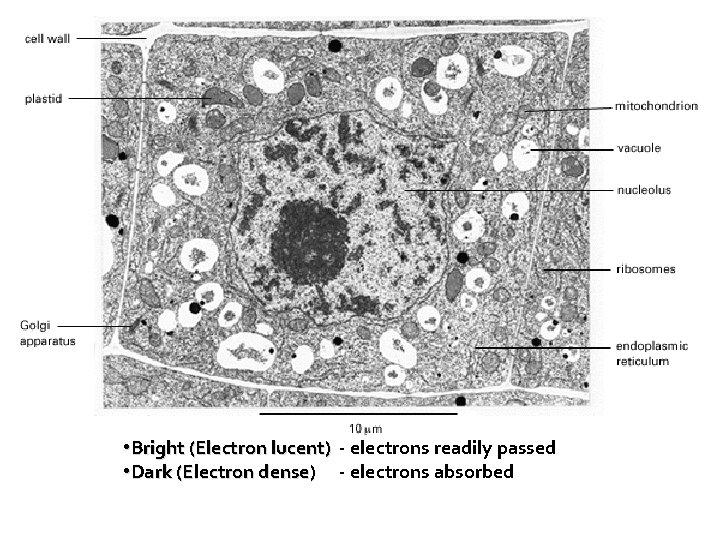  • Bright (Electron lucent) - electrons readily passed • Dark (Electron dense) -