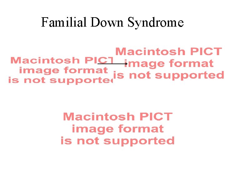 Familial Down Syndrome 