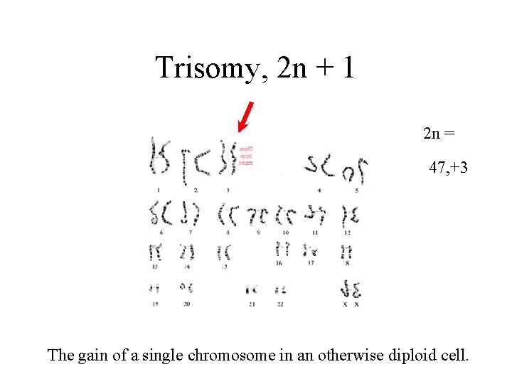 Trisomy, 2 n + 1 2 n = 46 47, +3 The gain of