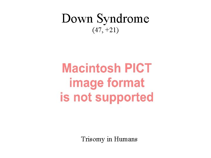 Down Syndrome (47, +21) Trisomy in Humans 