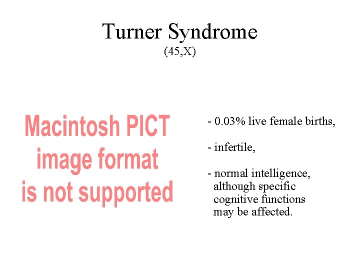 Turner Syndrome (45, X) - 0. 03% live female births, - infertile, - normal