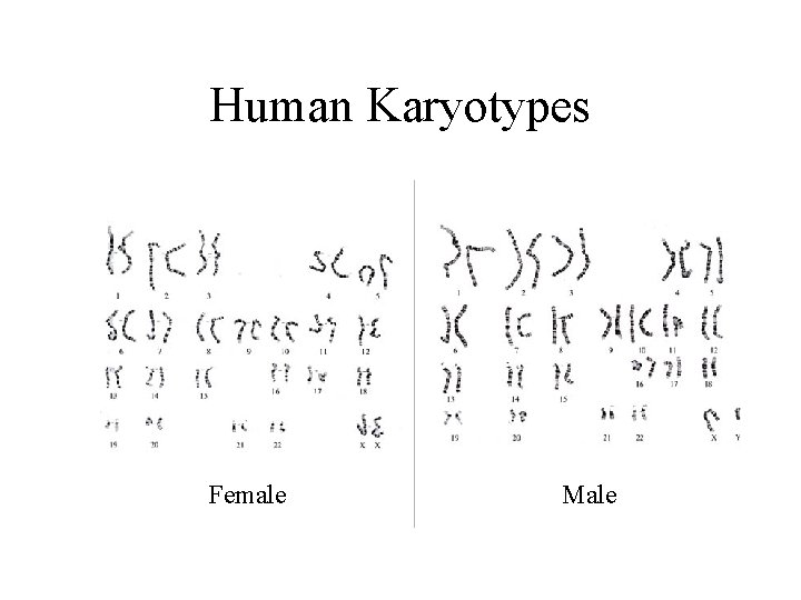 Human Karyotypes Female Male 