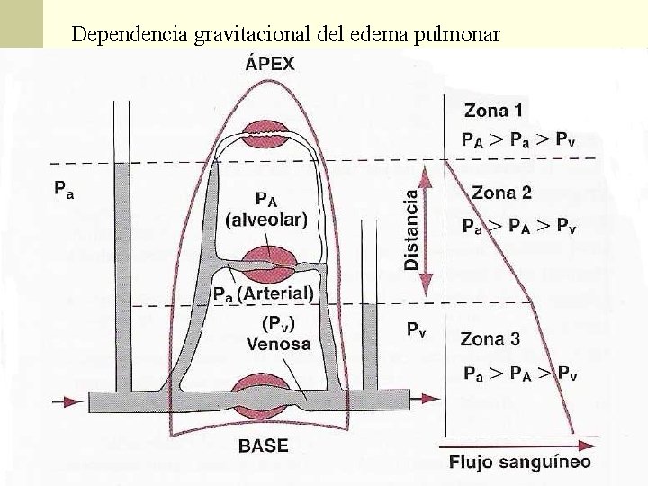 Dependencia gravitacional del edema pulmonar Dependencia gravitacional del edema pulmonar