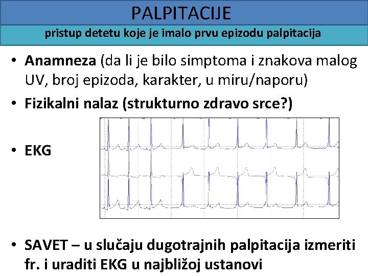 PALPITACIJE pristup detetu koje je imalo prvu epizodu palpitacija • Anamneza (da li je