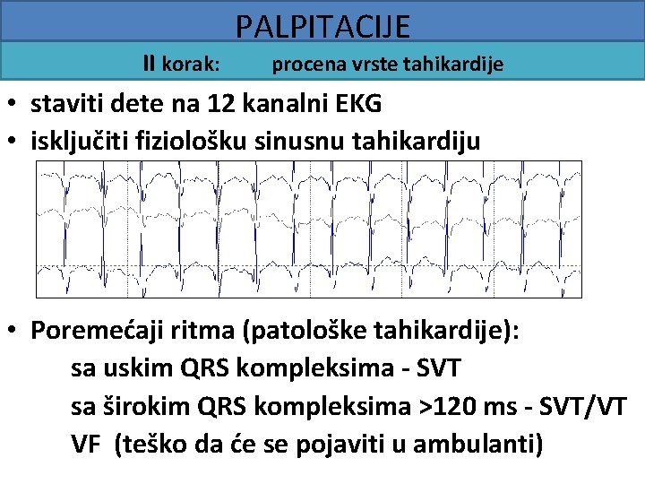 II korak: PALPITACIJE procena vrste tahikardije • staviti dete na 12 kanalni EKG •