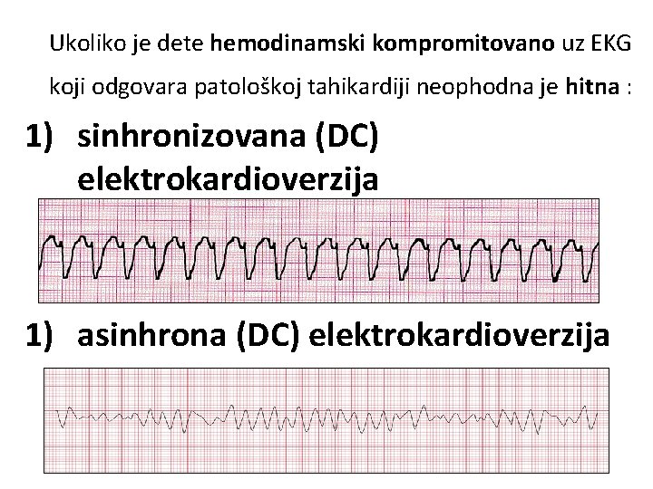 Ukoliko je dete hemodinamski kompromitovano uz EKG koji odgovara patološkoj tahikardiji neophodna je hitna