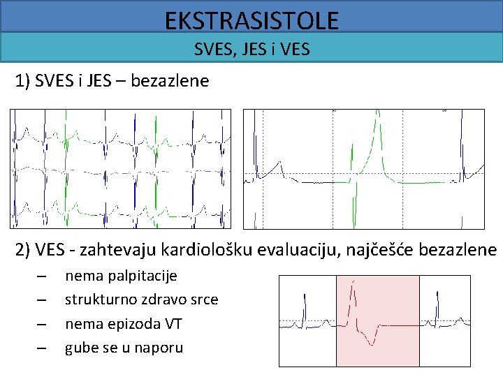 EKSTRASISTOLE SVES, JES i VES 1) SVES i JES – bezazlene 2) VES -