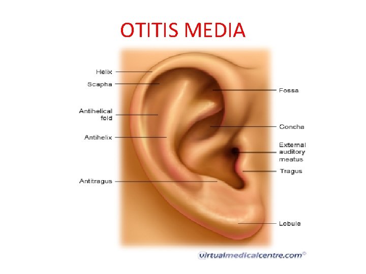 OTITIS MEDIA 