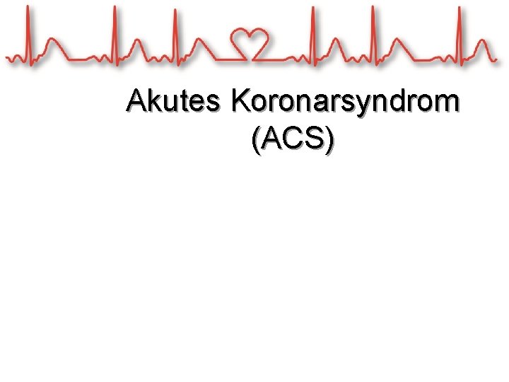 Akutes Koronarsyndrom (ACS) 