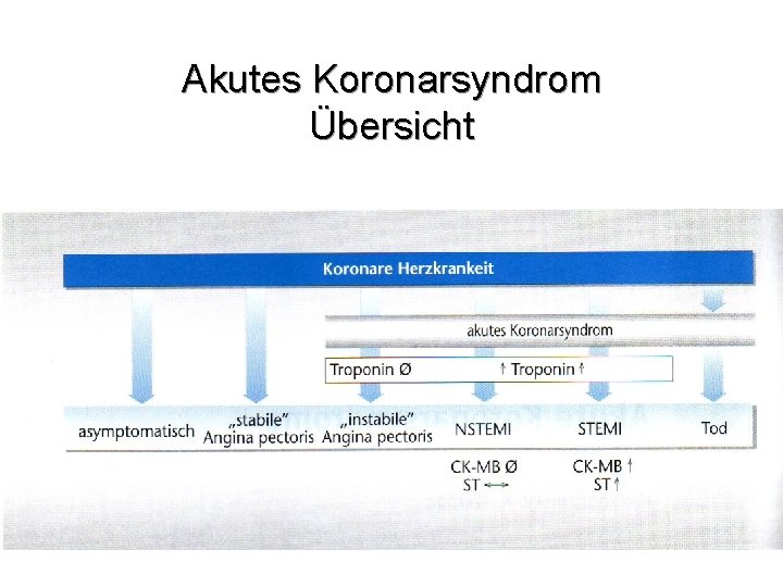 Akutes Koronarsyndrom Übersicht 