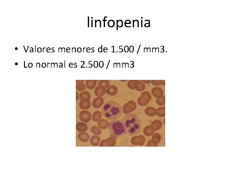 linfopenia • Valores menores de 1. 500 / mm 3. • Lo normal es