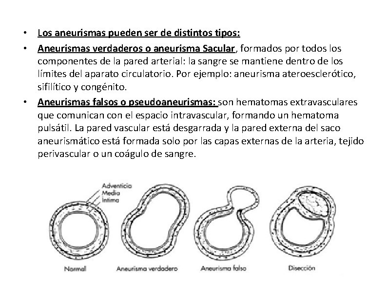  • Los aneurismas pueden ser de distintos tipos: • Aneurismas verdaderos o aneurisma