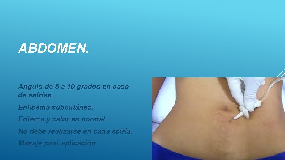 ABDOMEN. Angulo de 5 a 10 grados en caso de estrías. Enfisema subcutáneo. Eritema