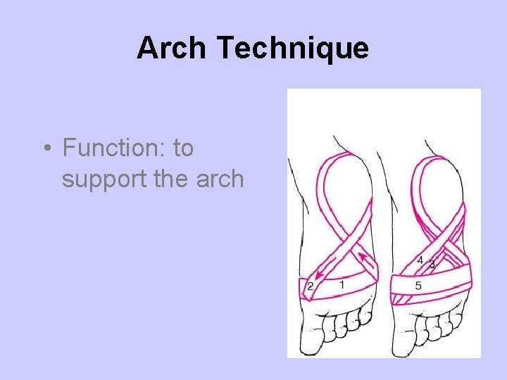 Arch Technique • Function: to support the arch 