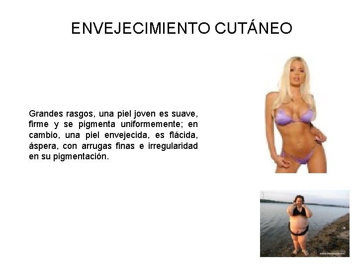 ENVEJECIMIENTO CUTÁNEO Grandes rasgos, una piel joven es suave, firme y se pigmenta uniformemente; ENVEJECIMIENTO CUTÁNEO Grandes rasgos, una piel joven es suave, firme y se pigmenta uniformemente;